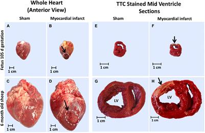 Differential Response to Injury in Fetal and Adolescent Sheep Hearts in the Immediate Post-myocardial Infarction Period